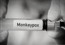 What is Monkeypox? A Detailed Guide. Monkeypox