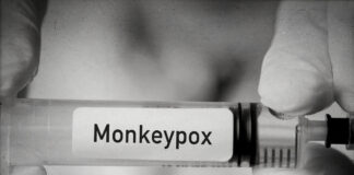 What is Monkeypox? A Detailed Guide. Monkeypox
