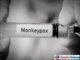 What is Monkeypox? A Detailed Guide. Monkeypox