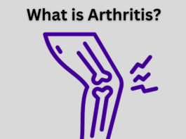 What is Arthritis?