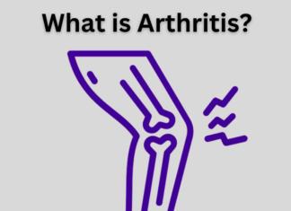 What is Arthritis? What Do You Need to Know? What is Arthritis?