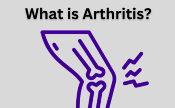 What is Arthritis? What Do You Need to Know? What is Arthritis?