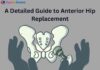 A Detailed Guide to Anterior Hip Replacement Anterior Hip Replacement