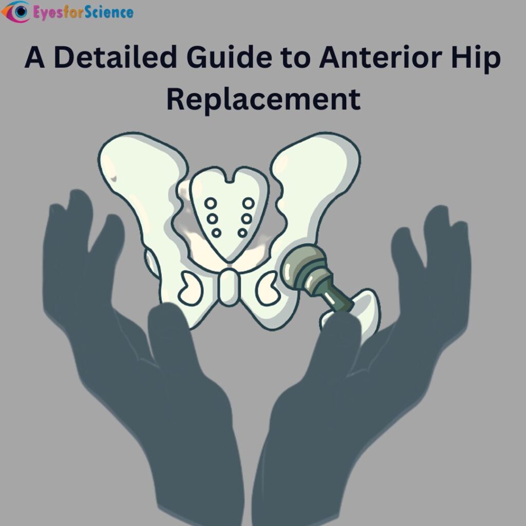 Anterior Hip Replacement A Detailed Guide