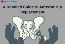 A Detailed Guide to Anterior Hip Replacement Anterior Hip Replacement