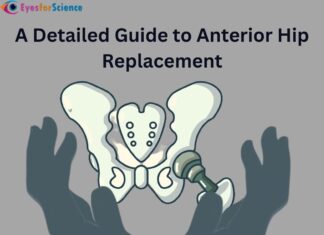 A Detailed Guide to Anterior Hip Replacement Anterior Hip Replacement