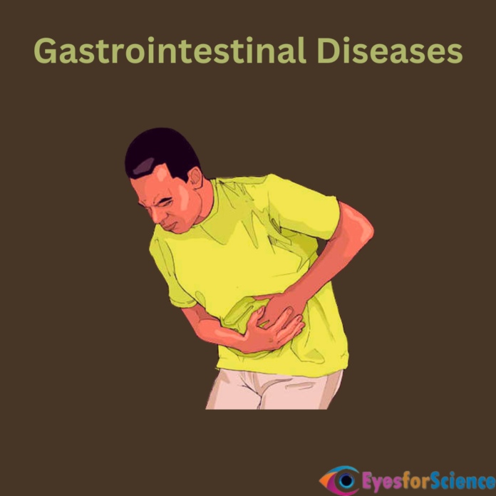 Gastrointestinal Diseases