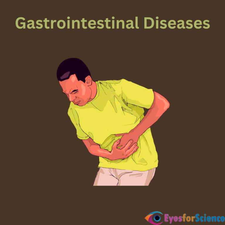 Gastrointestinal Diseases: Symptoms, Treatment & Causes Gastrointestinal Diseases: Symptoms, Treatment & Causes
