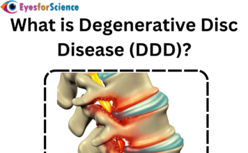 What is Degenerative Disc Disease (DDD)? What is degenerative disc disease?