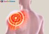 What is Rotator Cuff Injury? Rotator Cuff Injury