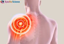 What is Rotator Cuff Injury? Rotator Cuff Injury