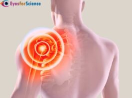 Rotator Cuff Injury