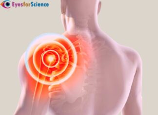 What is Rotator Cuff Injury? Rotator Cuff Injury