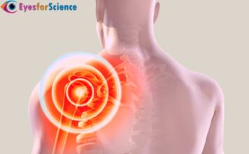 What is Rotator Cuff Injury? Rotator Cuff Injury