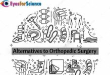 Alternatives to Orthopedic Surgery Alternatives to orthopedic surgery