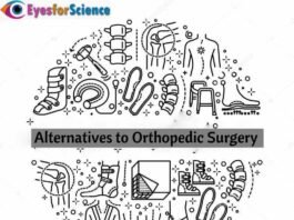 Alternatives to orthopedic surgery