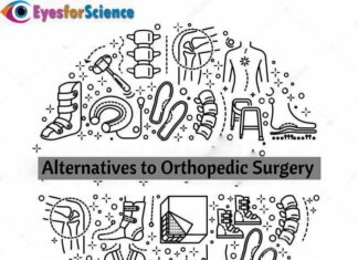 Alternatives to Orthopedic Surgery Alternatives to orthopedic surgery