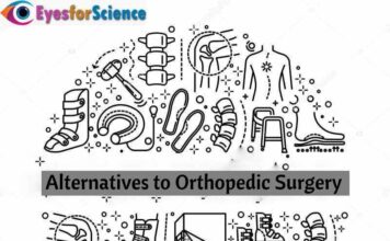 Alternatives to Orthopedic Surgery Alternatives to orthopedic surgery