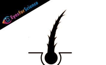 Split Ends – A Quick Guide Split Ends